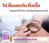 Mole Erase Remove Skin Tags Mole Freckle Care Solution