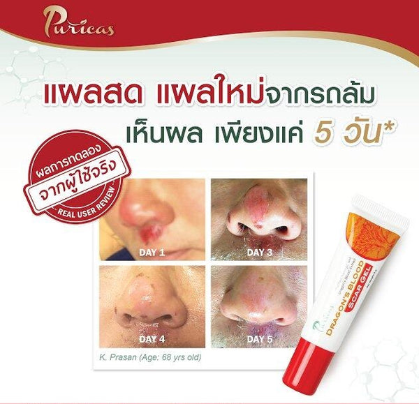 Puricas Dragon’s Blood Scar Gel Concentrated Red Spots Care