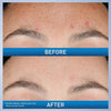 CeraVe Resurfacing Retinol Serum With Ceramides & Niacinamide For Blemish-Prone Skin 30 mL