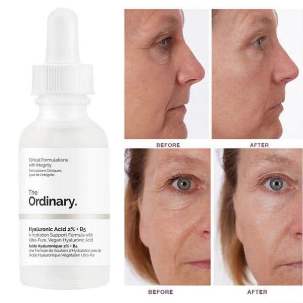 The Ordinary Hyaluronic Acid with 2% + B5 30mL