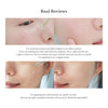 Dr. Althea Skin Relief Essence 30 mL