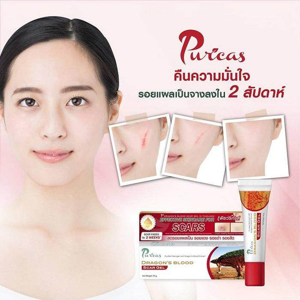 Puricas Dragon’s Blood Scar Gel Concentrated Red Spots Care
