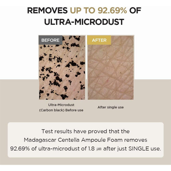 SKIN1004 مادغشقر سينتيلا أمبول فوم، 125 مل
