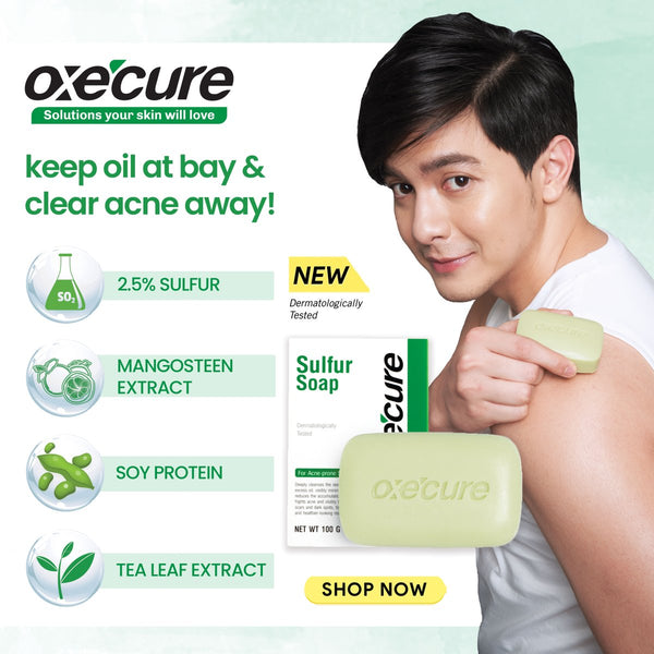 Oxe Cure Sulfur Soap Pimple Acne Scar Oily Control