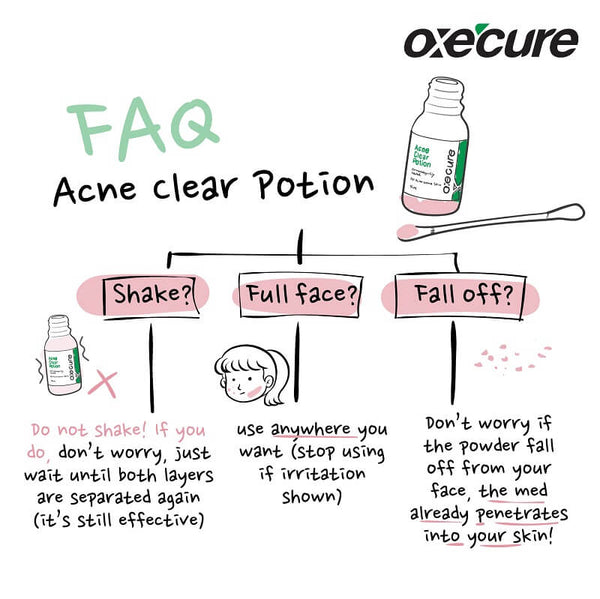 Oxe Cure Acne Clear Potion 2% Salicylic Acid Pimple Treatment