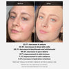 medicube Red Acne Succinic Acid Peel 40g (1.41 oz)