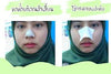 Lively Nose Green Tea by Nakiz Blackhead Removal Pore Cleansing